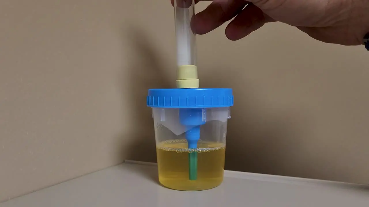 Urine sample filling vacuum test tube for urinalyses