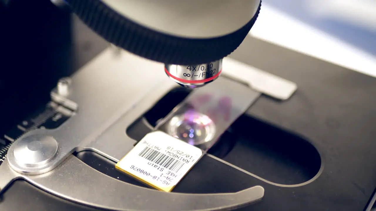 Close up on a scientist using a microscope on a medical slide with human cancer cells in a medical research laboratory