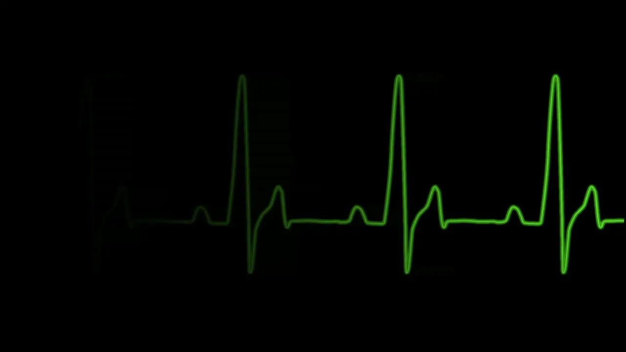 EKG-Herzfrequenzdiagramm