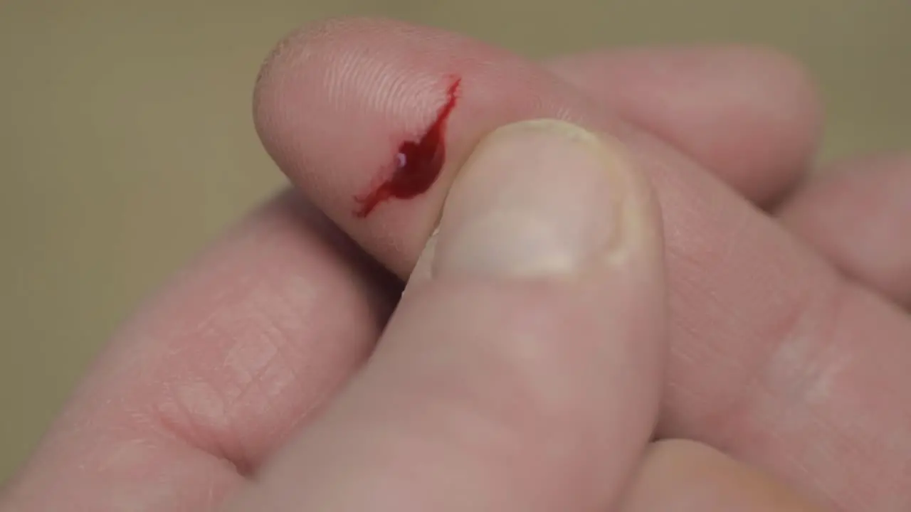 Paper cut on finger with drop of blood close up