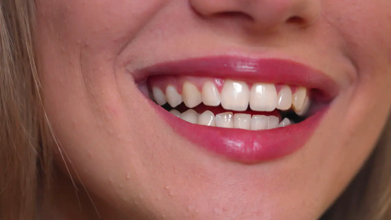 Closeup on beautiful white smile of young woman