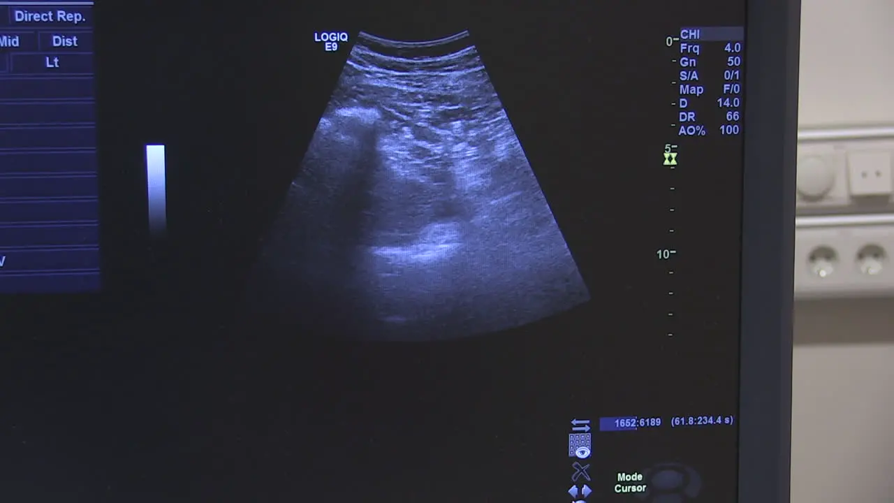 Ultrasound Screen 2