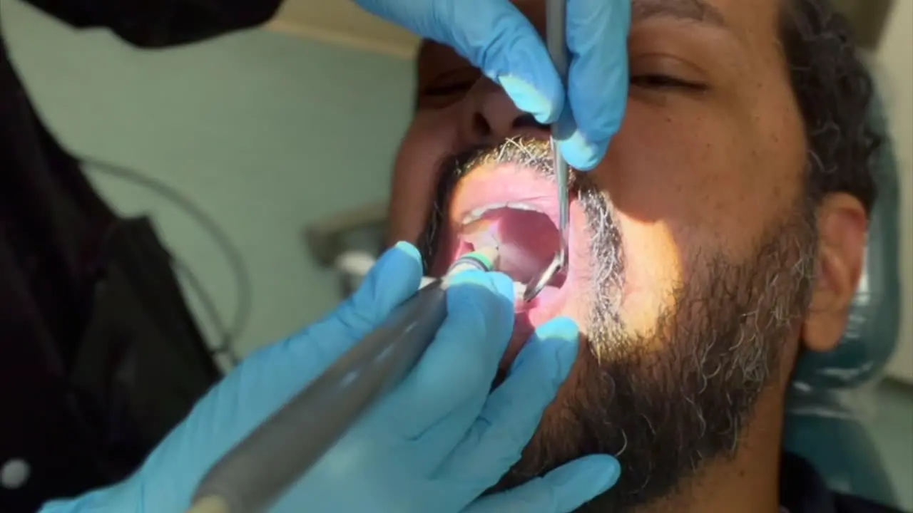 A close-up view of a middle aged man with a beard at the dentist