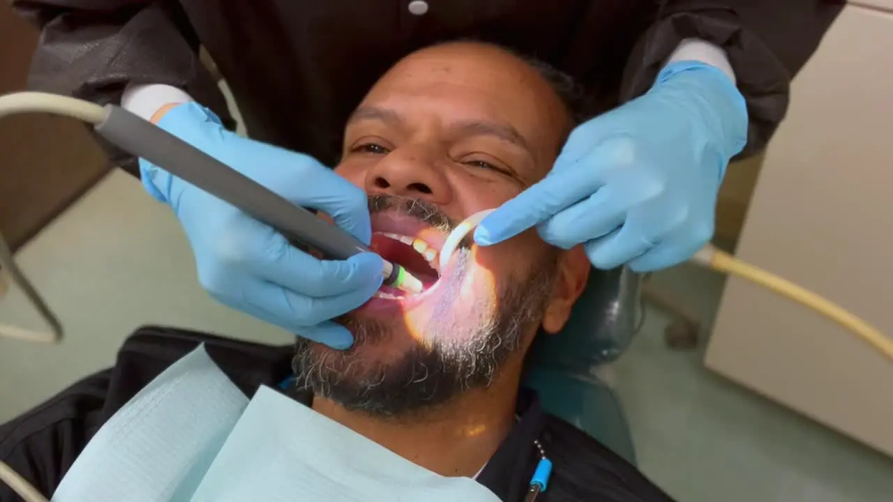 A close-up view of a middle aged man of mixed races with a beard at the dentist getting his teeth cleaned by a dental hygienist