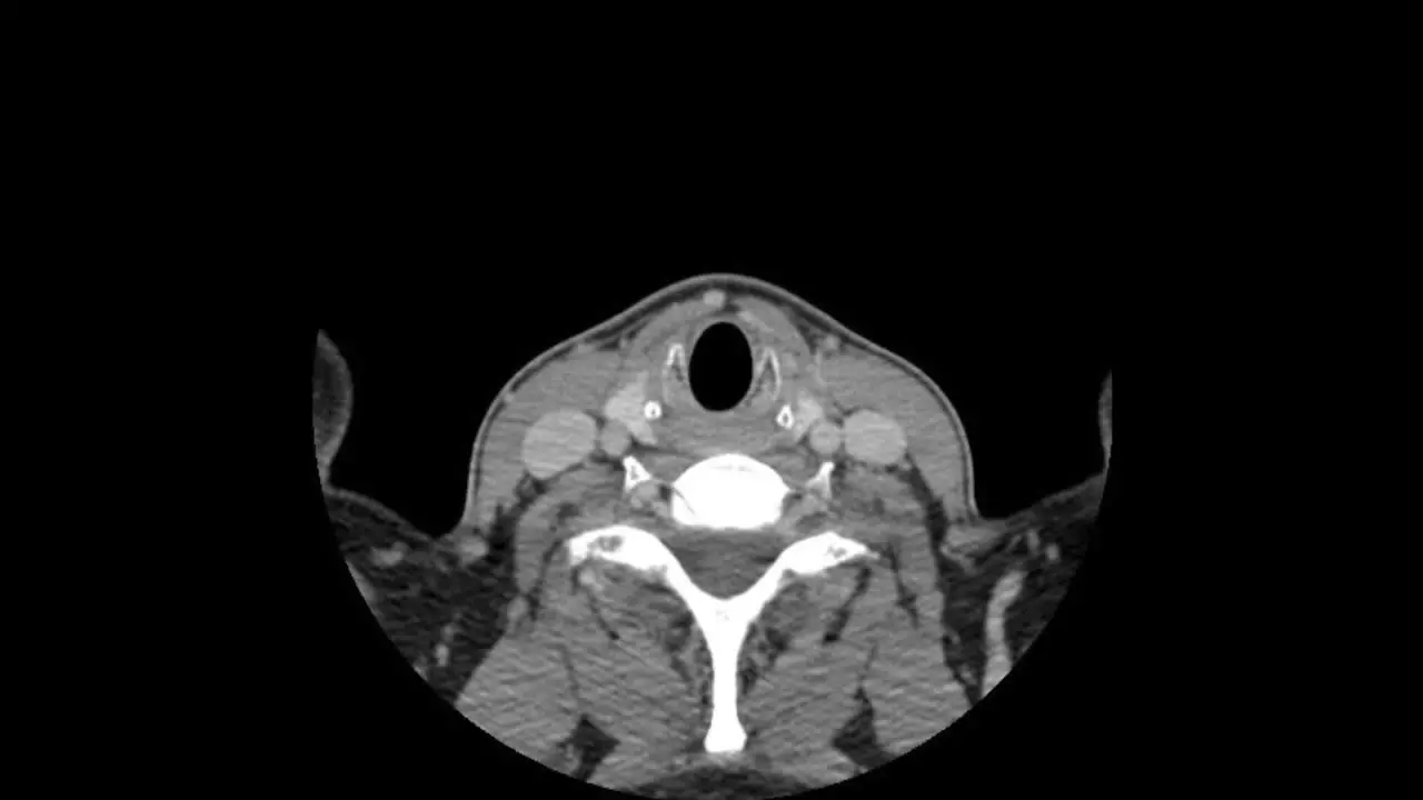 Axial CT Computed Tomography scan layers of head and chest no text