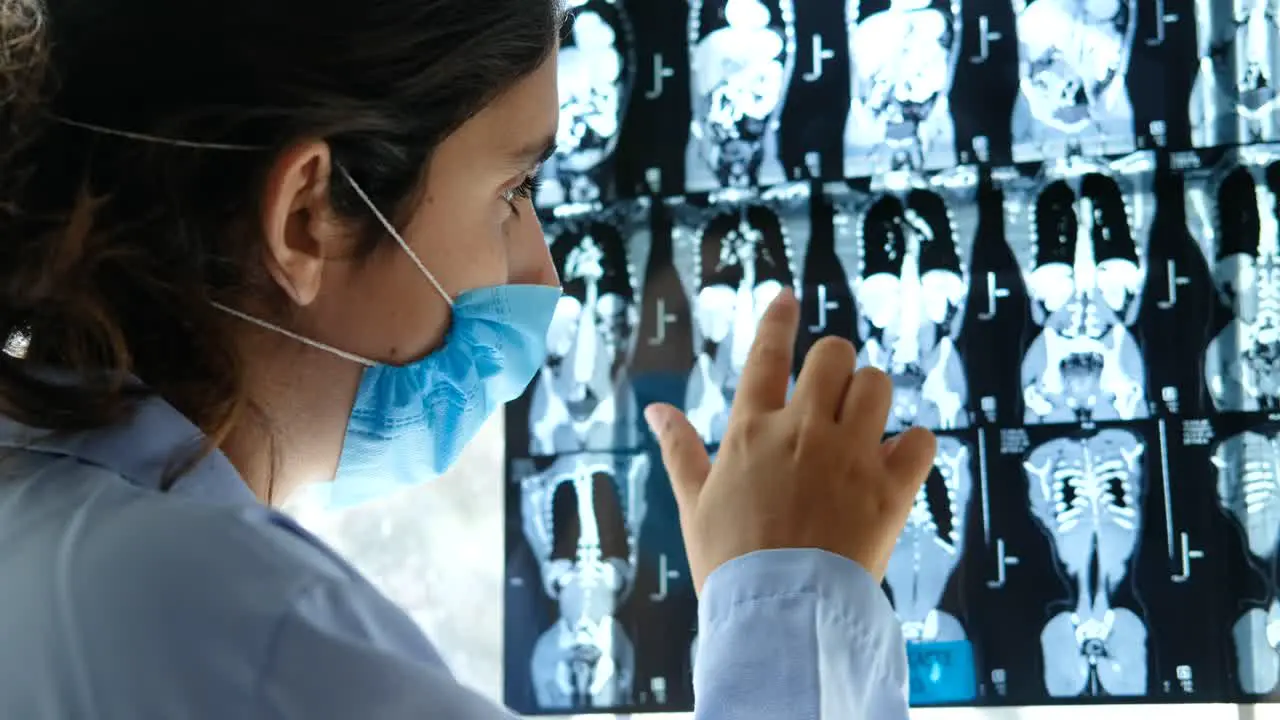 close up of female doctor discussing an MRI scan