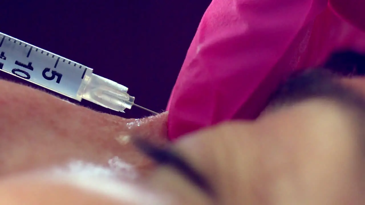 Close up of a woman receiving Botox injection treatment therapy