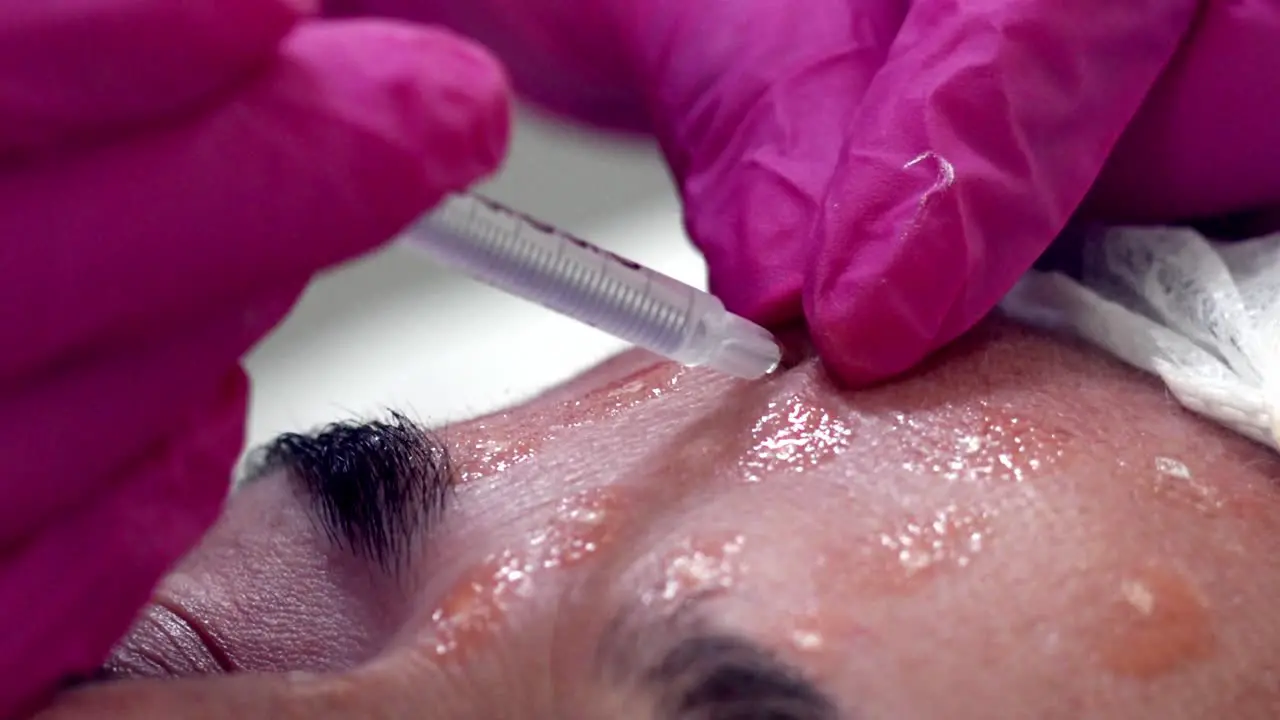 A woman getting Botox injections on her face close up detail