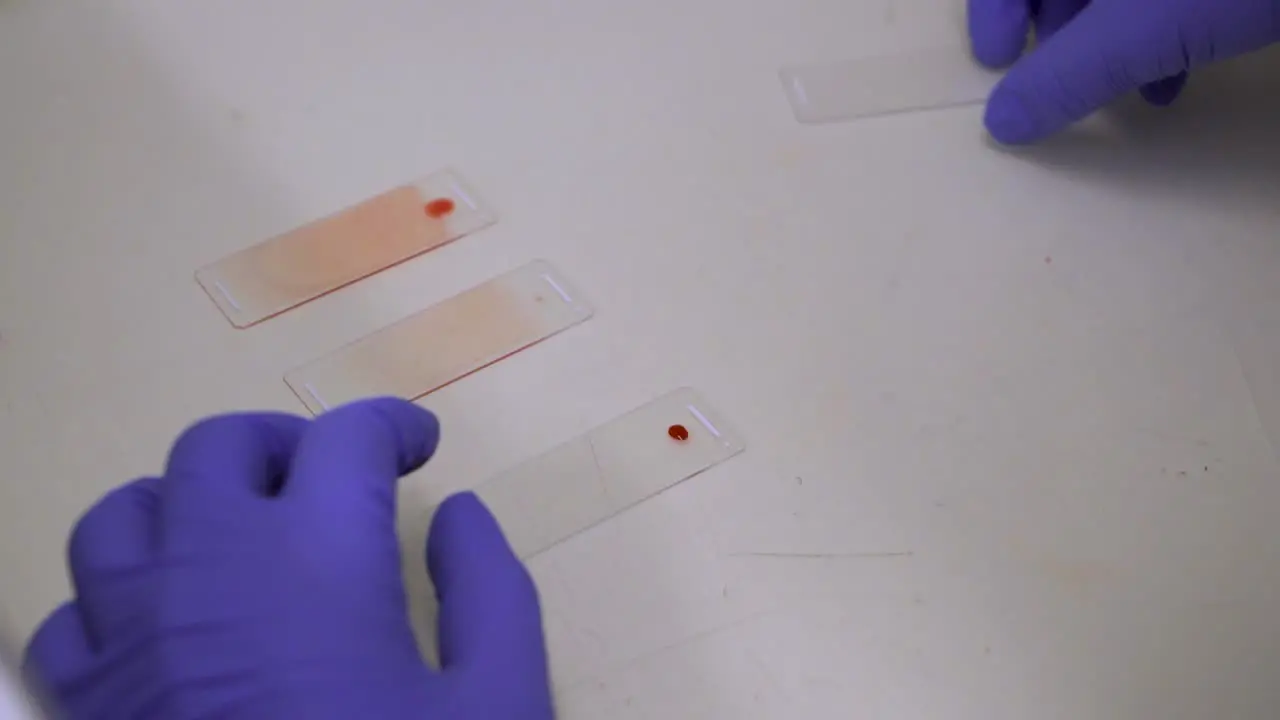 Placing Drop Of Blood Sample On One End Of Glass Microscope Slide Blood Film