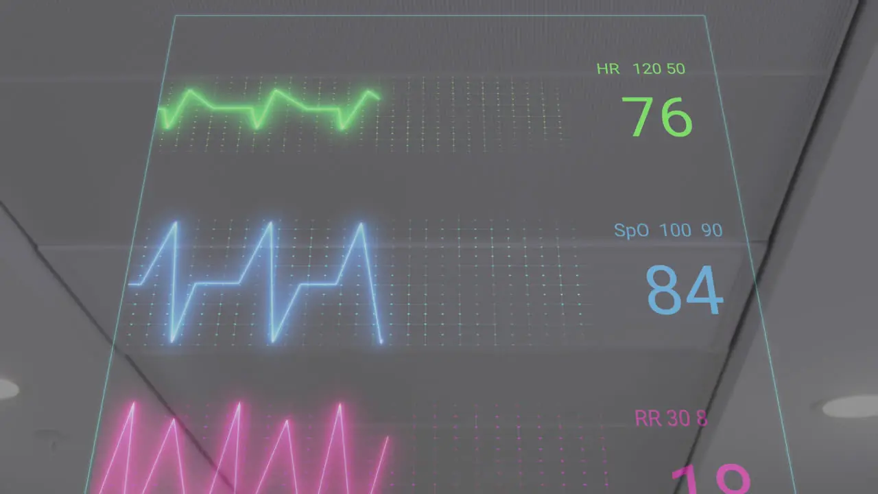 Animation of heart rate monitor against view of roof at hospital