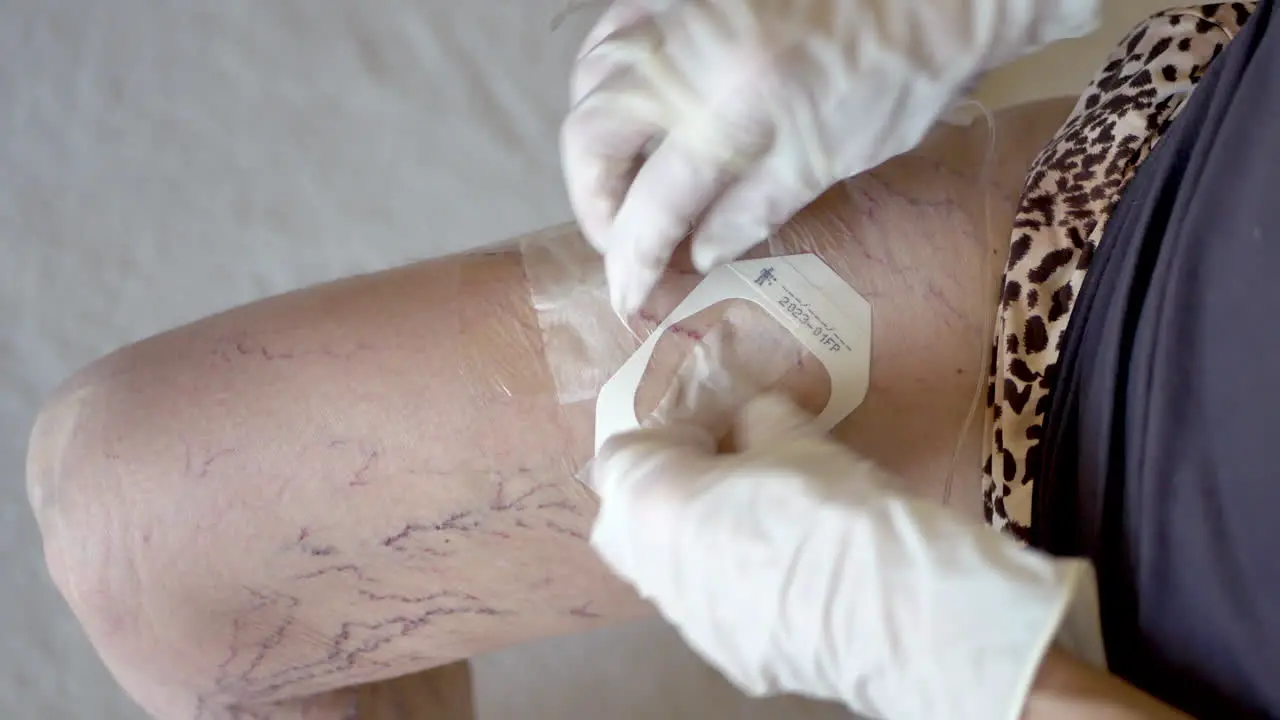 Middle aged woman medical patient with varicose veins applying a plastic bandage to her inner thigh during an at home antibiotic infusion treatment