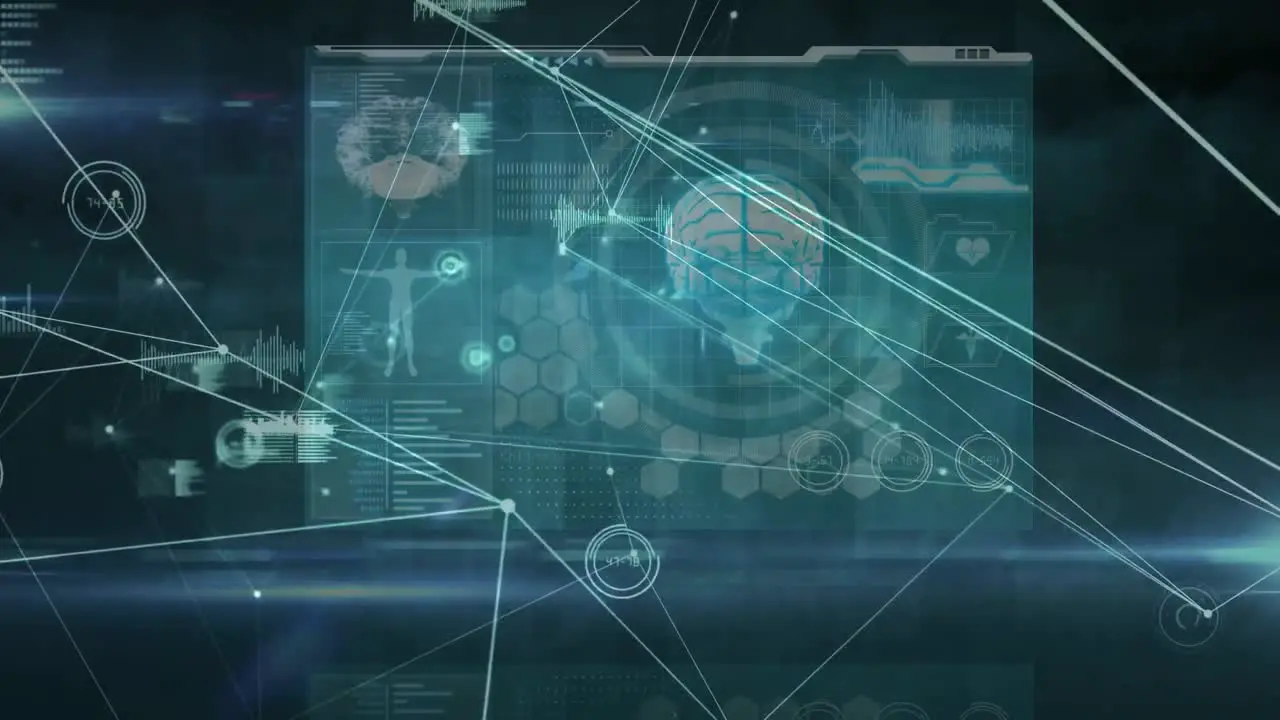 Animation of network of connections and data processing against medical data processing