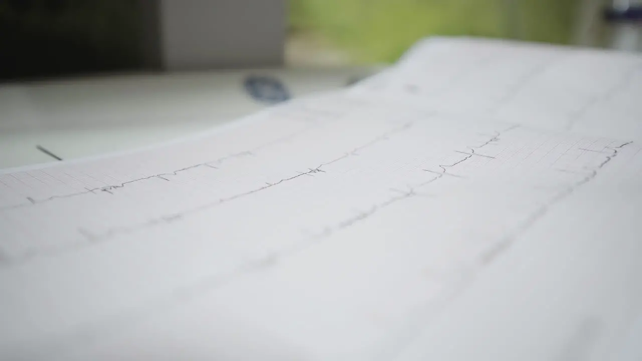 Ecg heart lines stable patient activity reports closeup