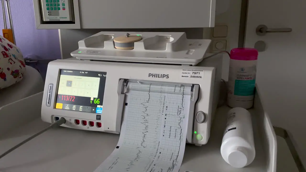 Modern Cardiotocography of Philips scanning heartbeat of baby at hospital close up Medical Cardiotocography scanner