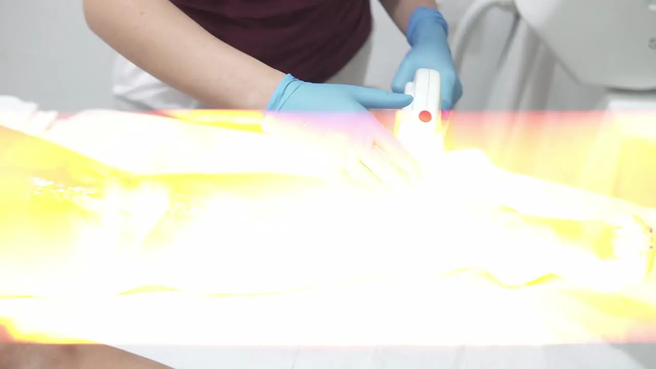 Tracking shot of a woman getting laser hair removal on her legs in a clinic