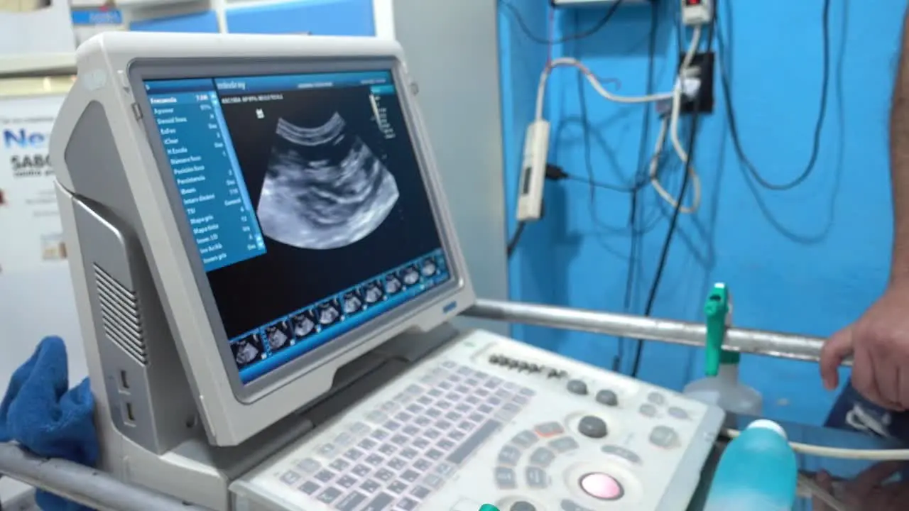 Close-up shot of a vet diagnosing problems using an ultrasound machine and pointing