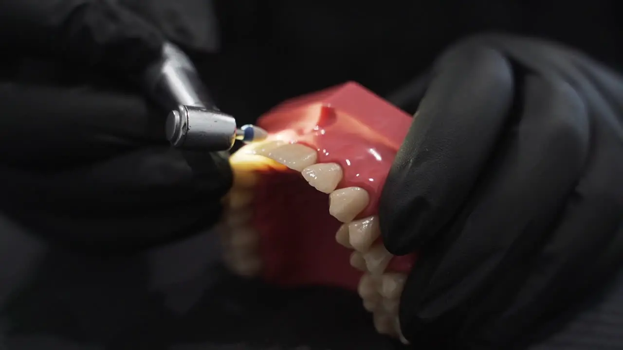 Dental composite Polishing Demonstration with Grinding Drill Eye level extreme close up