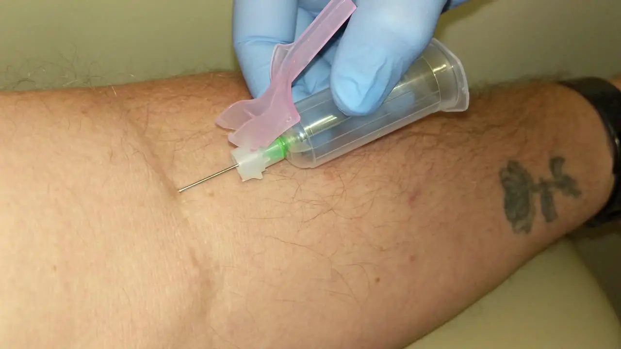 Blood being drawn from a persons left arm by a nurse and the tube being removed a gauze is put on the punture point