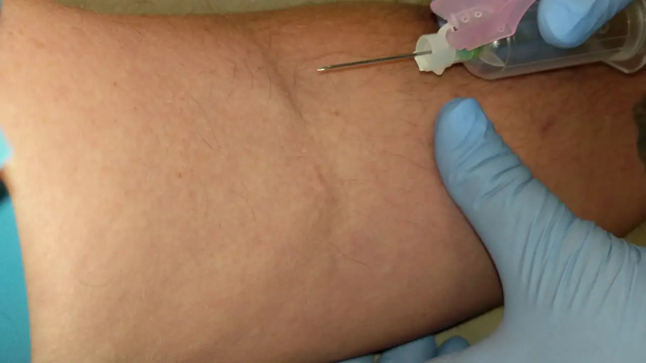 A vien being checked and a collection needle is inserted in the left arm of a patient