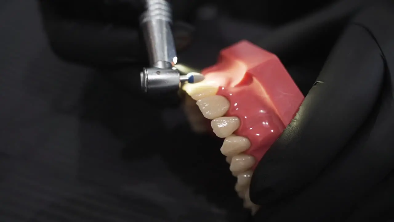 Dental Polishing Demonstration with Grinding point Drill Detail close up