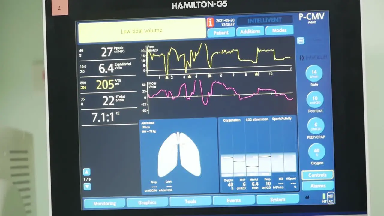 Close Up Footage of Monitor Screens Showing COVID-19 Infected Patient Health Conditions