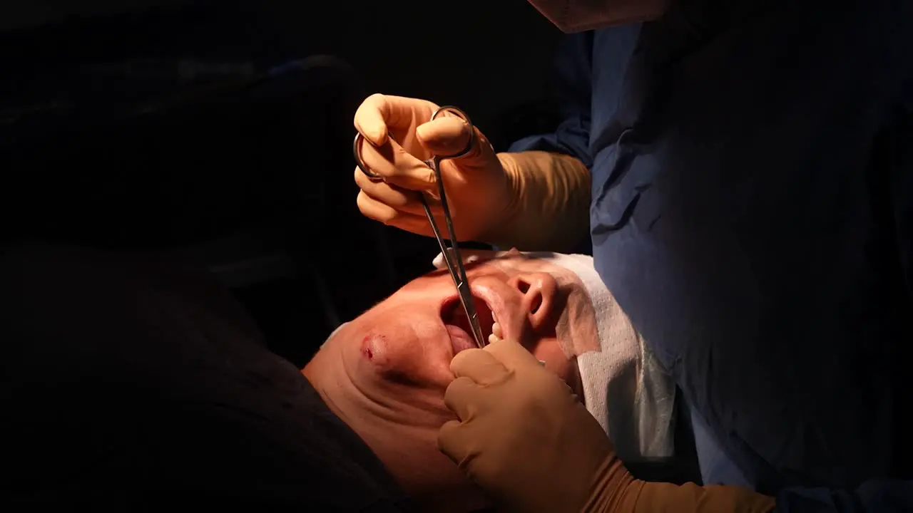 bichectomy jowl liposuction surgery in operating room doctor operating on face cosmetic surgery skin rejuvenation