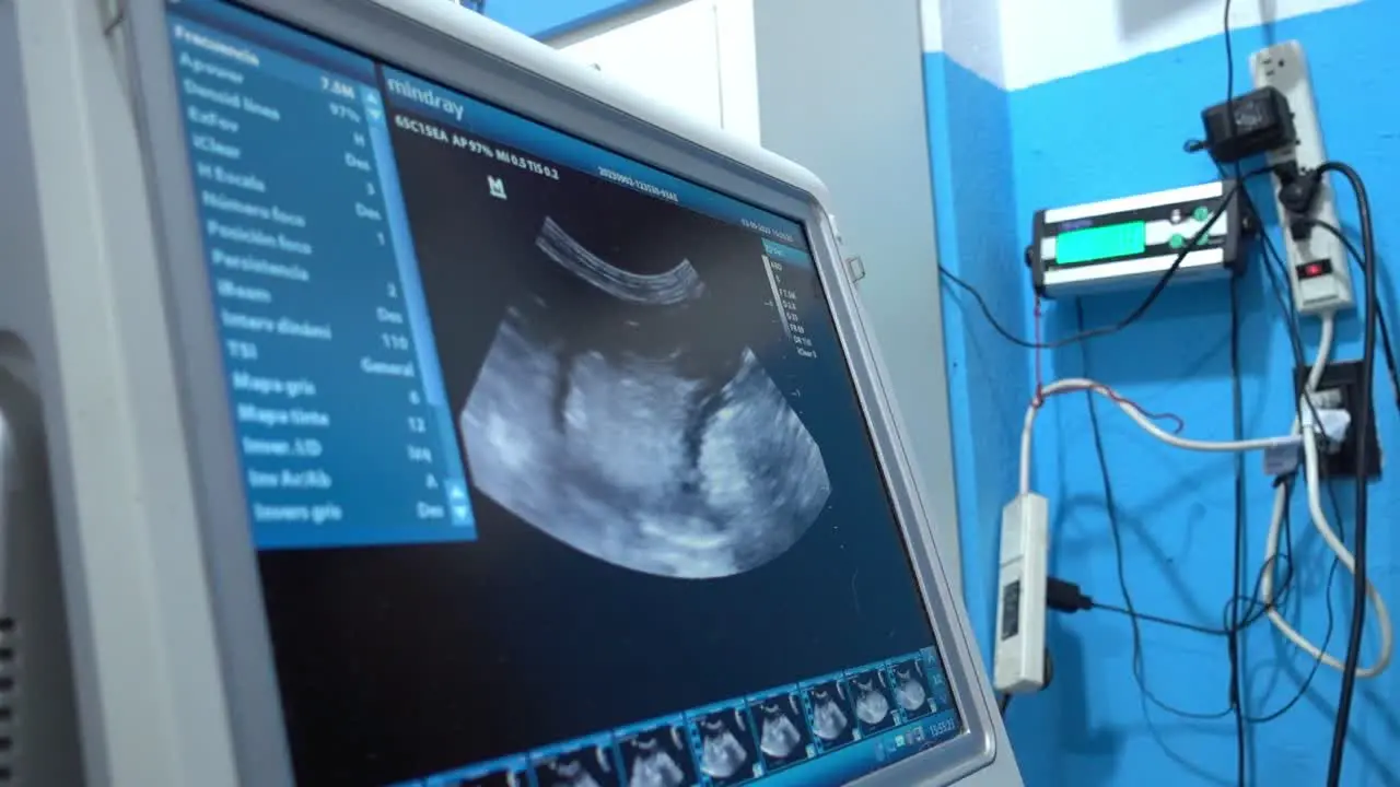 Push in shot showing the images being transmitted to an ultrasound machine from an animal