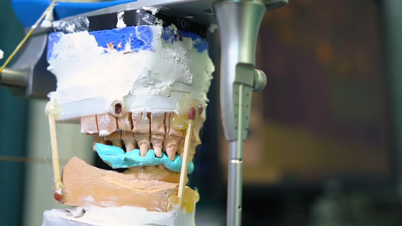 Static shot of a dental mould being imprinted within a dental laboratory