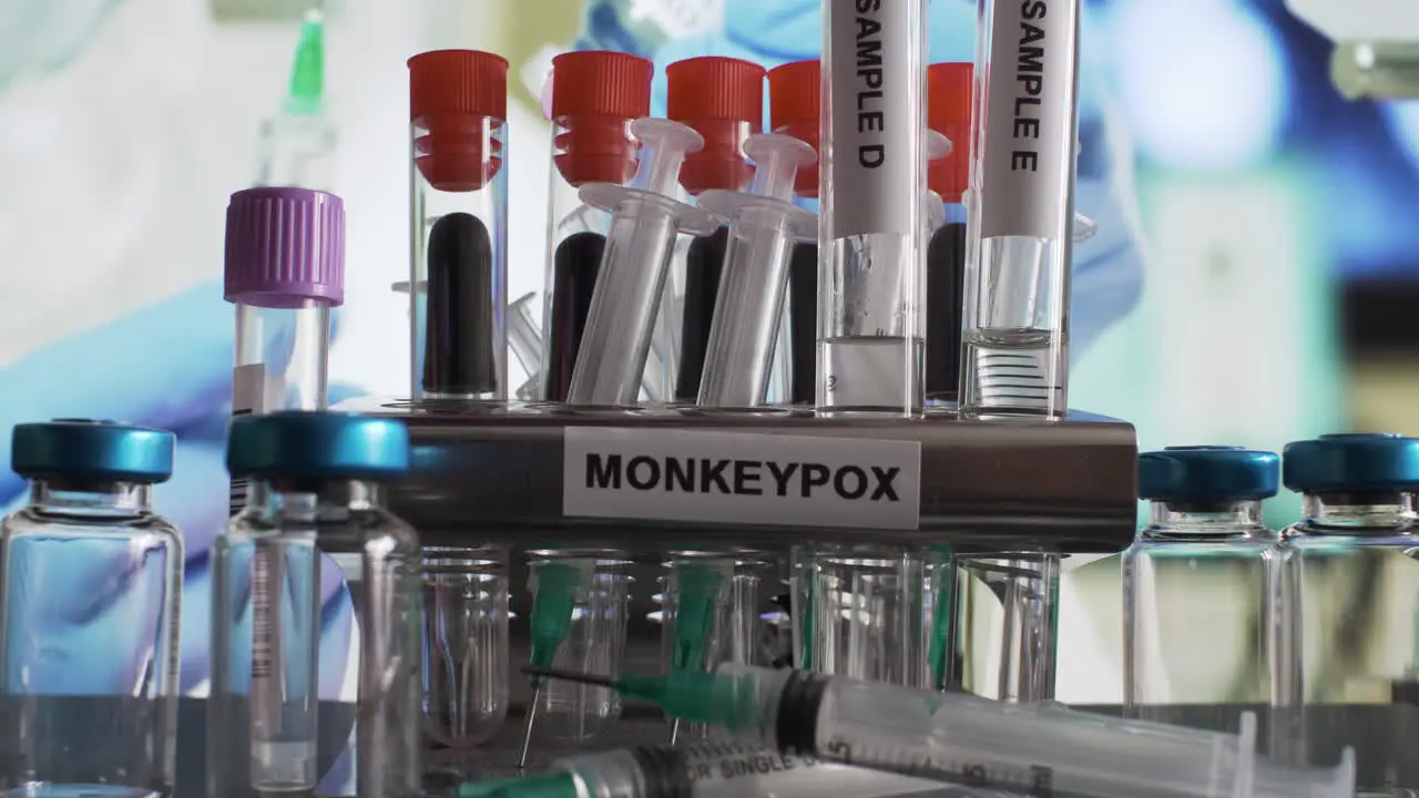 Monkeypox Test Tube Samples Being Removed From Rack