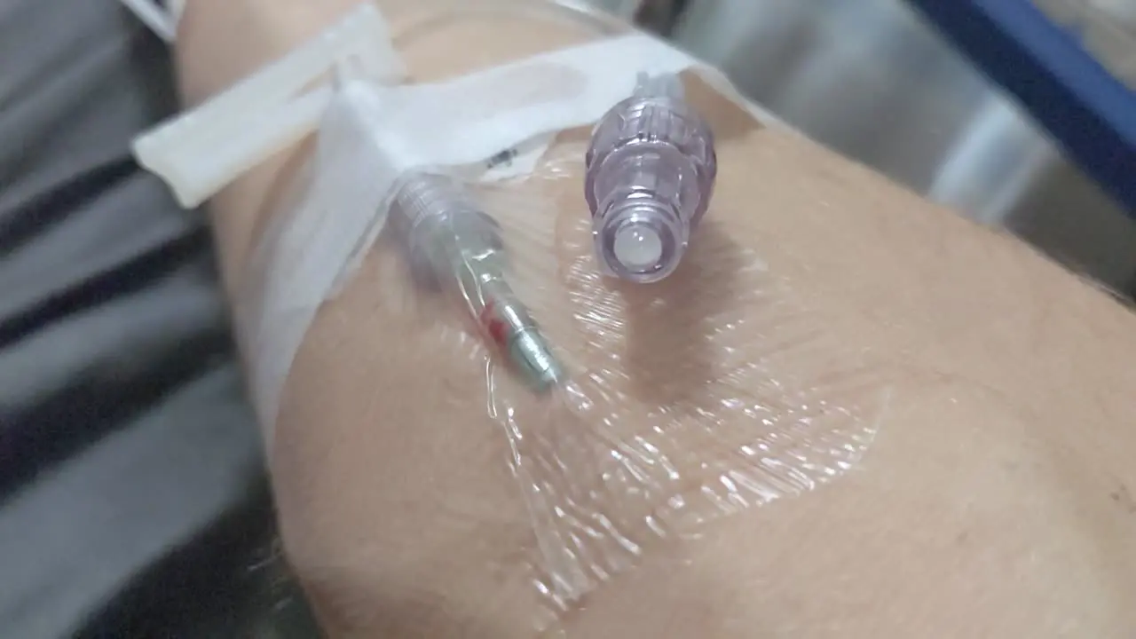 Close up of an intravenous inserted into an unidentifiable male right arm