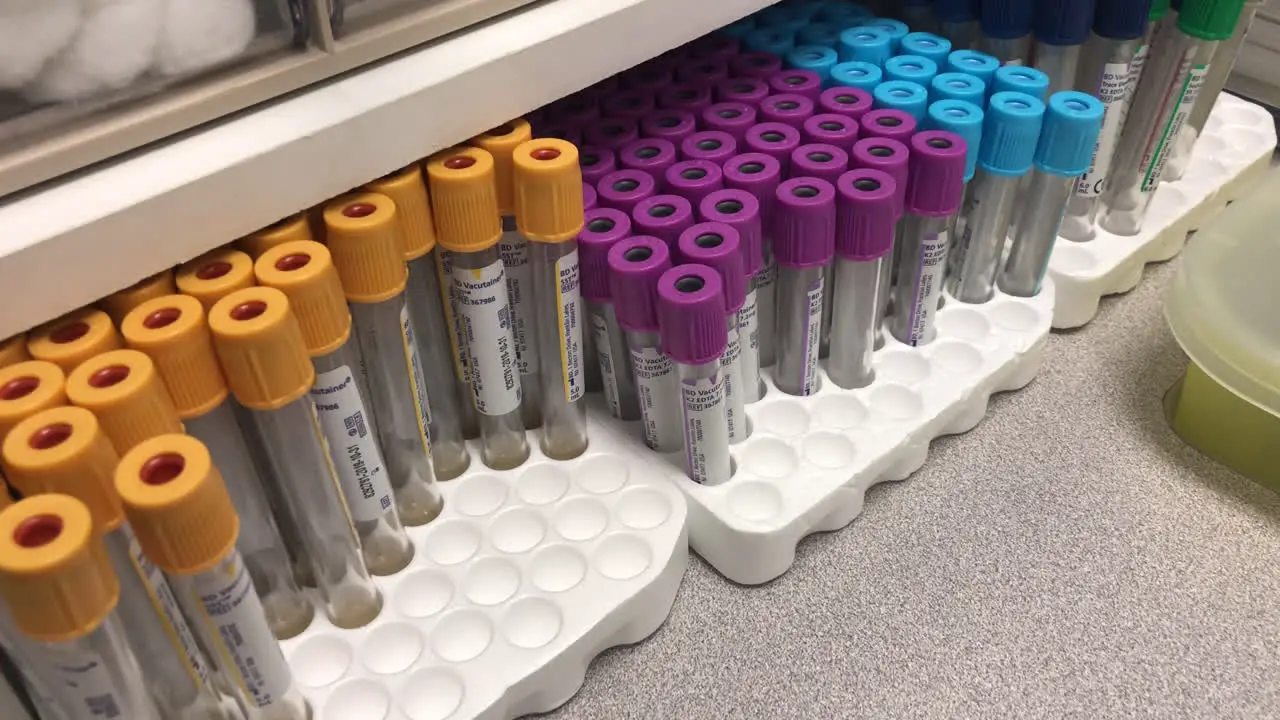 Blood collection vials of different colors in a health care facility