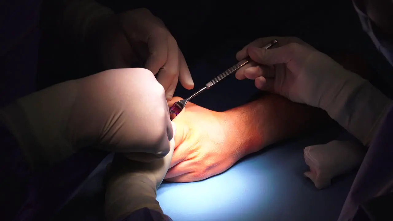 The act of performing surgery may be called a surgical procedure operation or simply "surgery