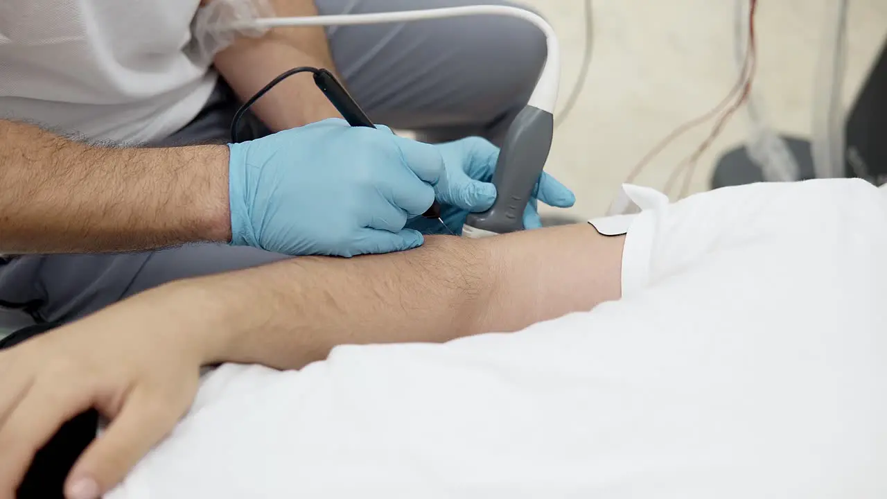 Patient Laying Down Having Acupuncture Technic On His Arm Muscle Stimulation Technic