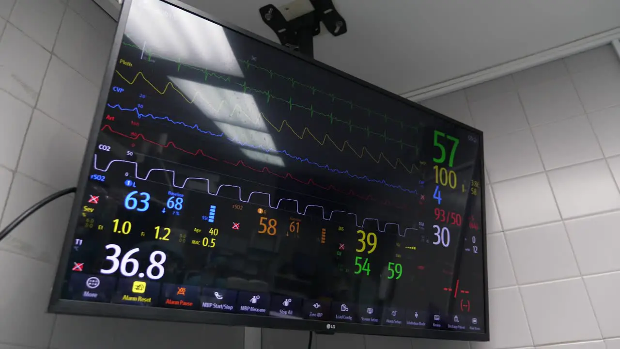 Operating room monitor displaying heart rate and blood pressure