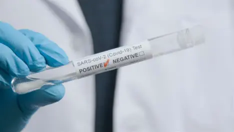 Close Up Shot of Medical Professionals Hand Holding COVID Positive Test Tube 