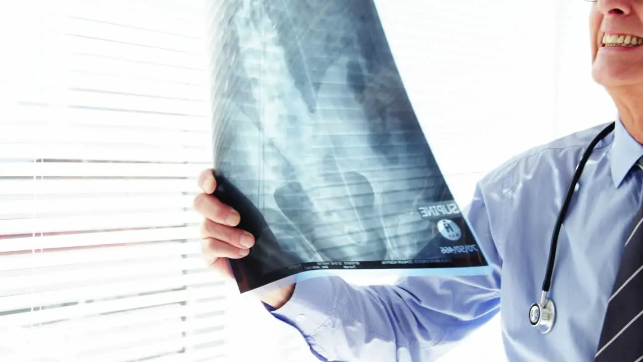 Male doctor examining x-ray