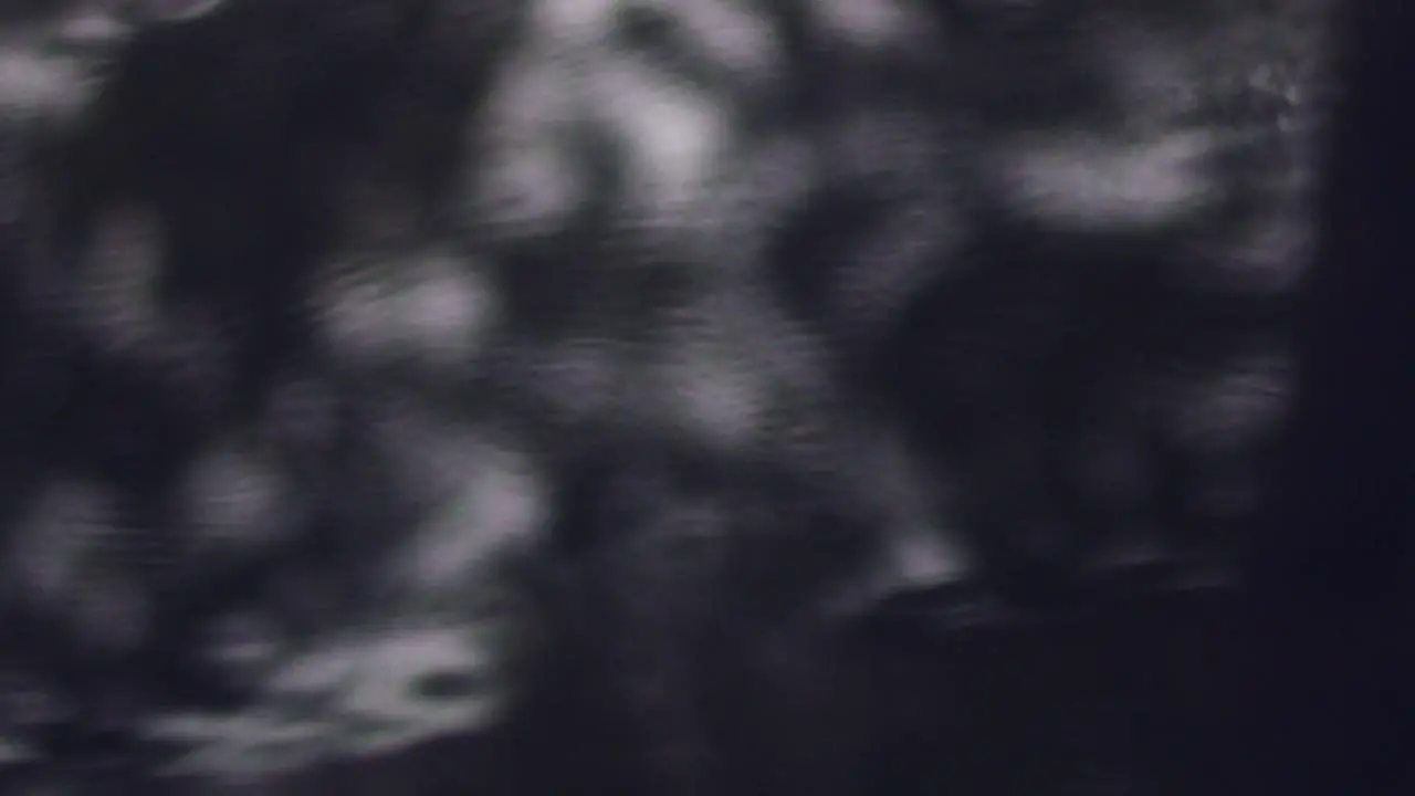 Blurry shots of raindrops falling on a footpath in a shiny rain puddle close up