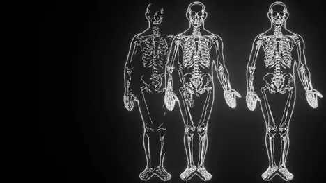 Comparing xrays