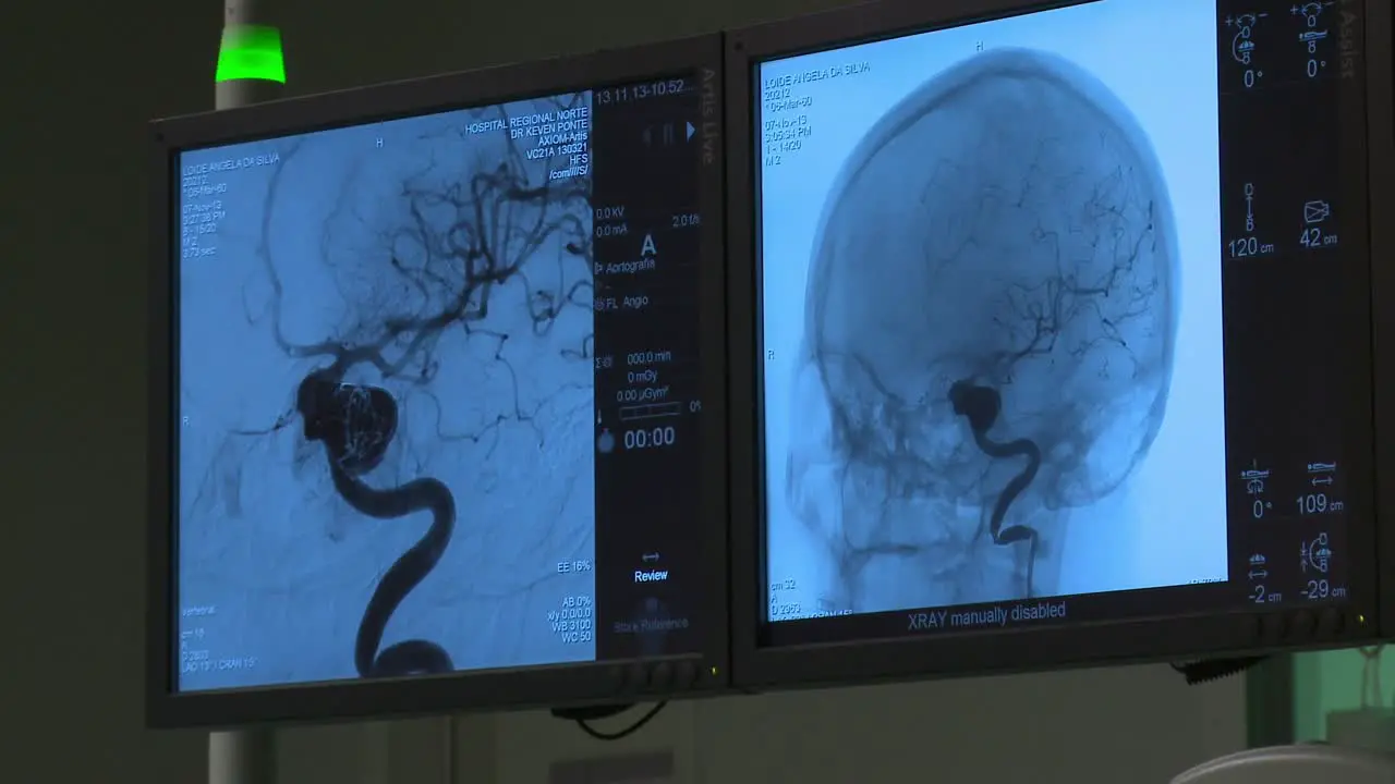 Results of patient medical scan displayed on hospital monitor screen