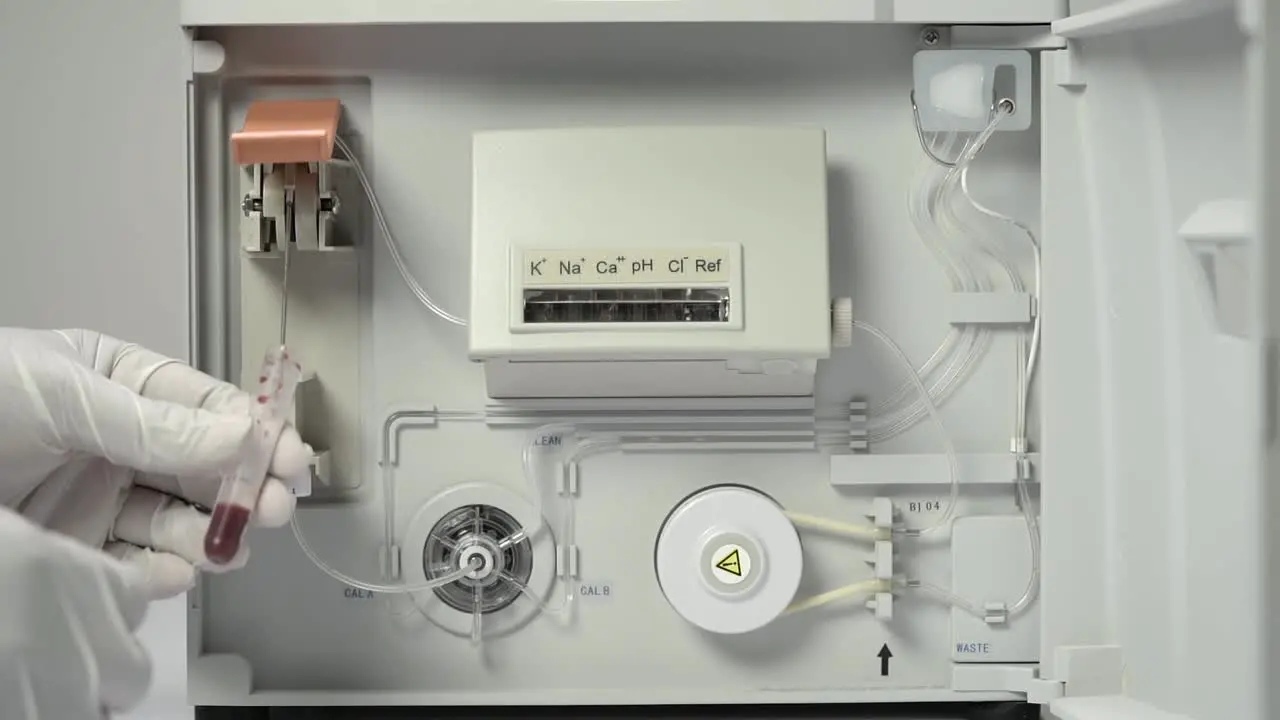 Medical Technologist Hands In White Gloves Put The Tube With Blood Sample On Electrolyte Analyzer