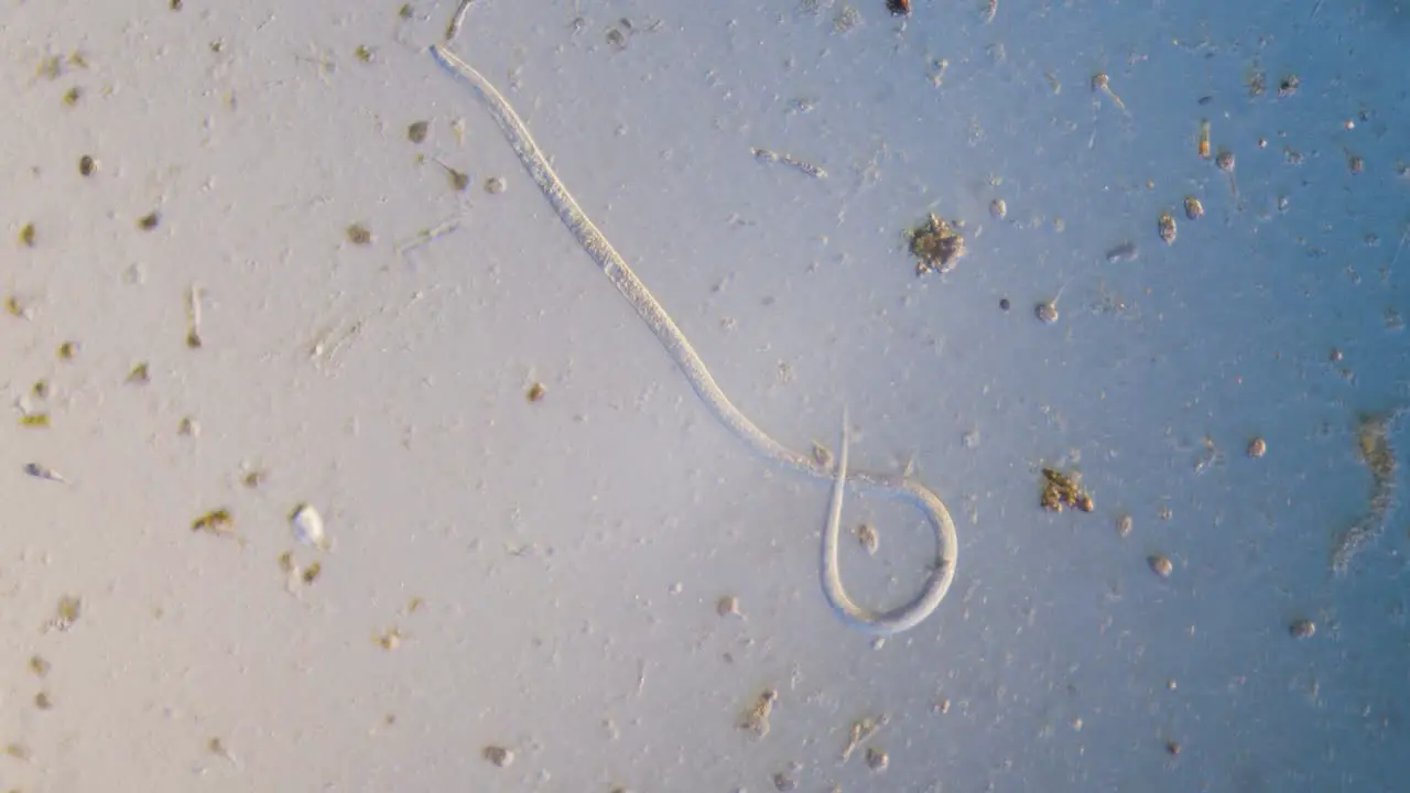 Nematode parasitic worm in microscope bright field