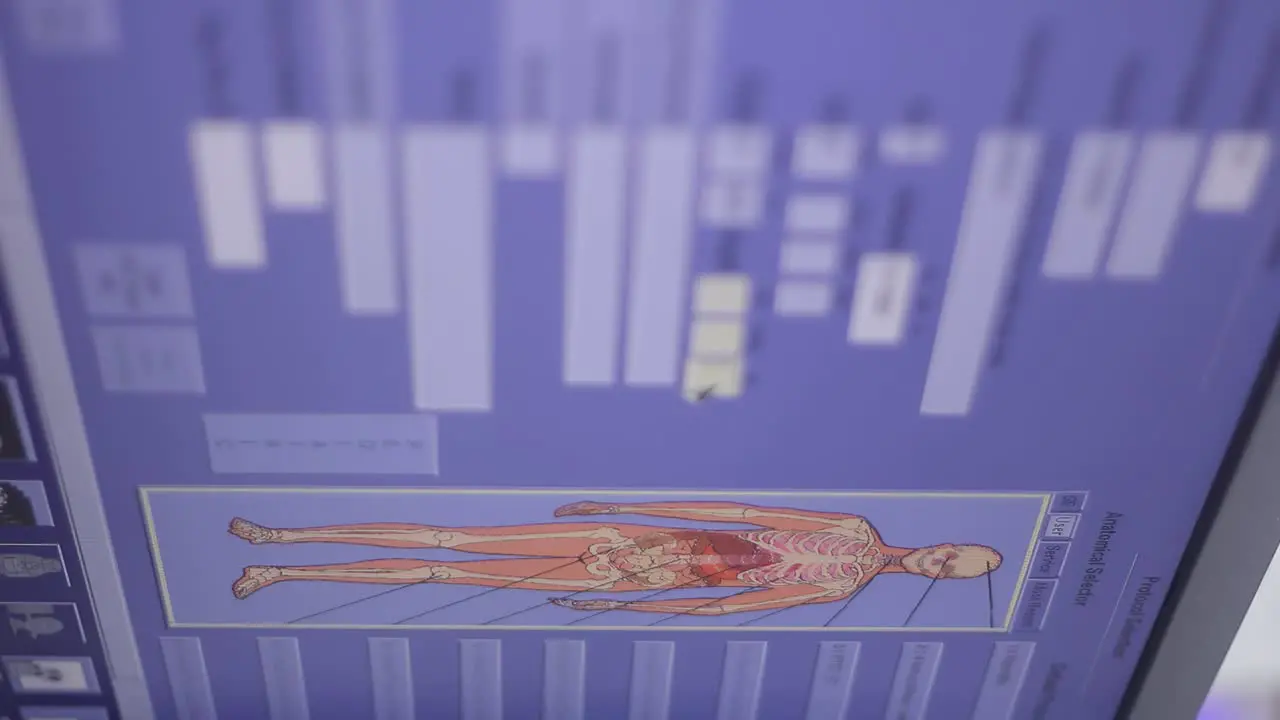 Monitor displaying information about a patient as he is registered in a clinic's database to be scanned with a machine known as SPECT which scans patients with tumors in different parts of the body