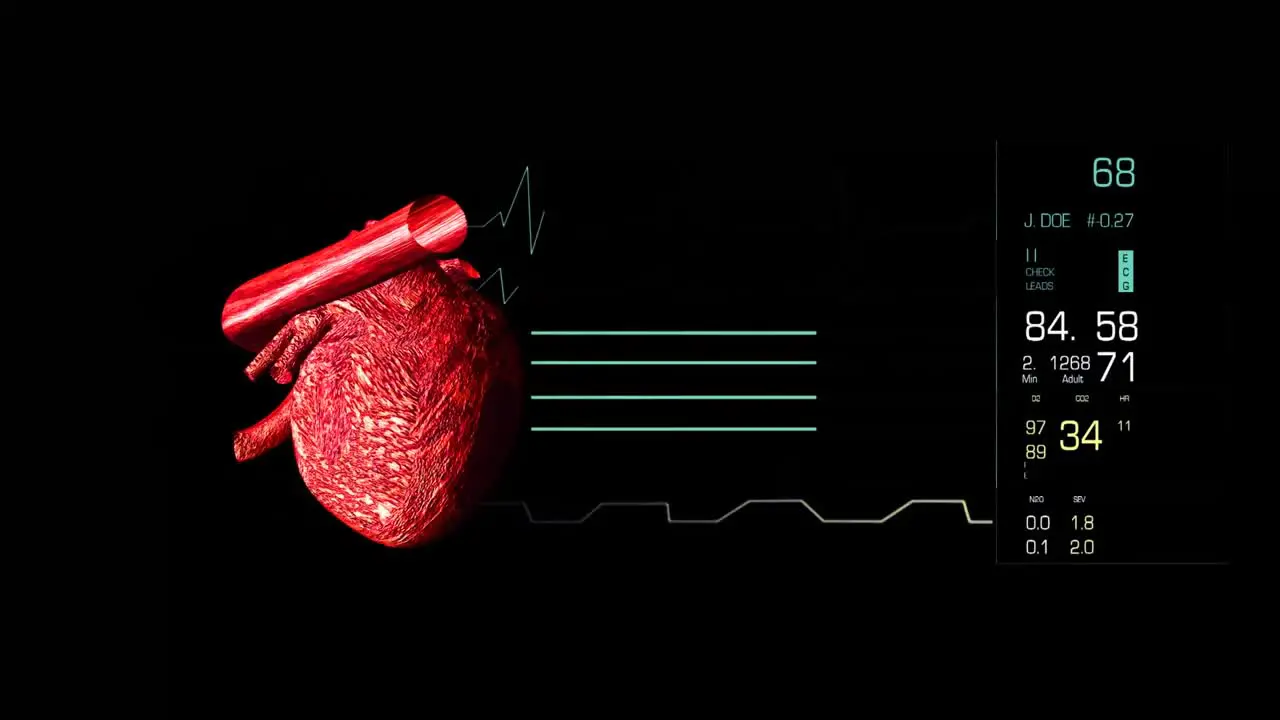 Vídeo De Un Electrocardiograma