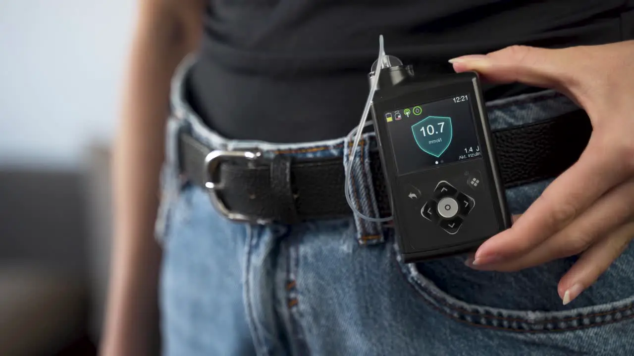 Diabetic female showing insulin pump on her waist belt close up