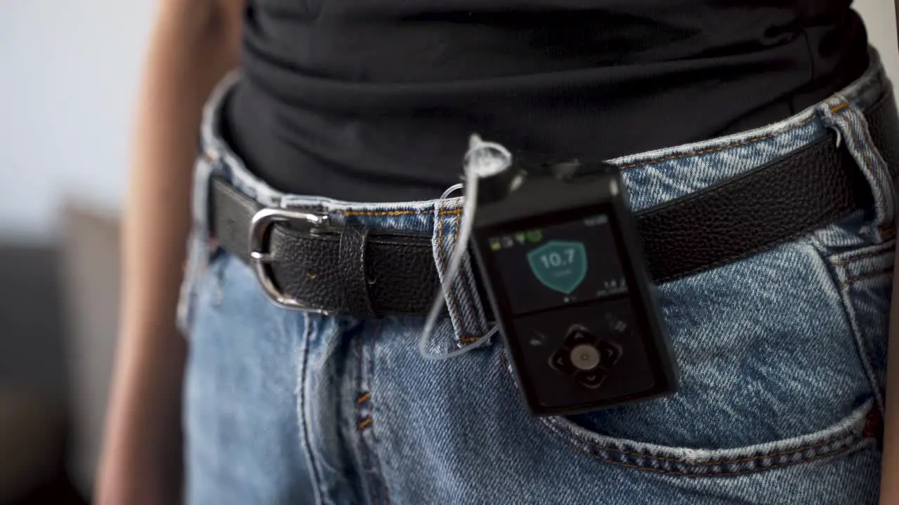 Diabetic female switching on insulin pump on her waist belt close up