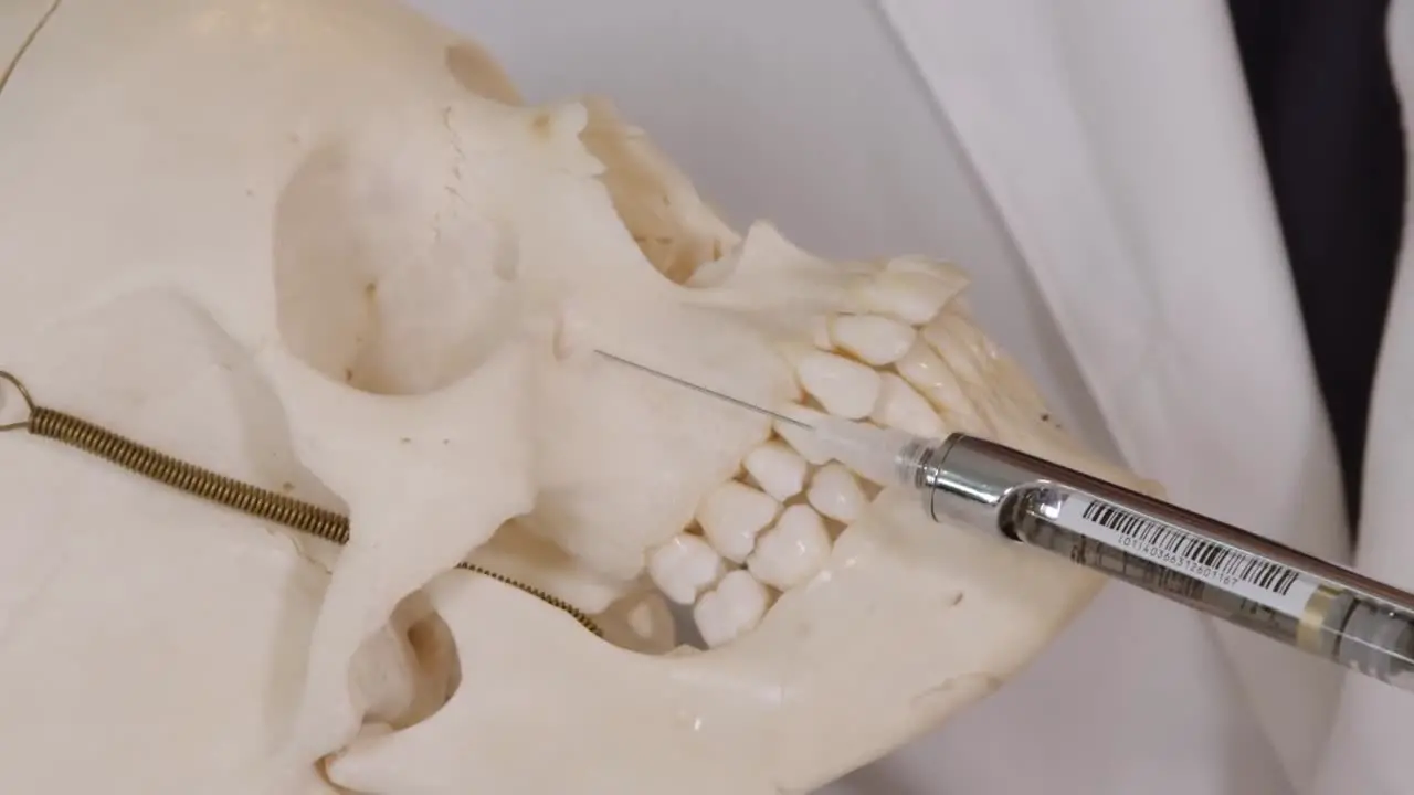 infraorbital nerve block dental anesthesia demonstrated on human skull