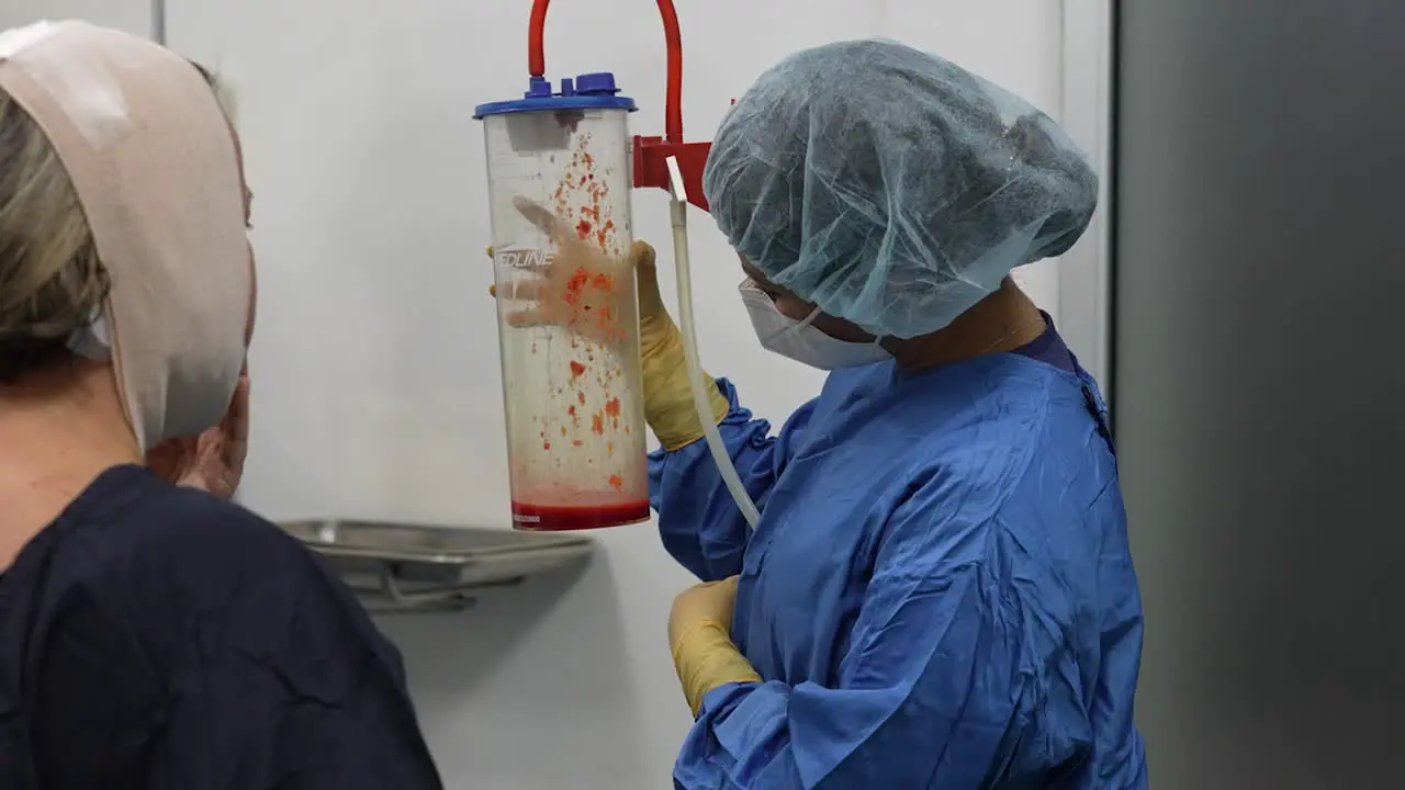 doctor showing removal of fat from jowls and stomach with liposuction blood with fat operating room hospital