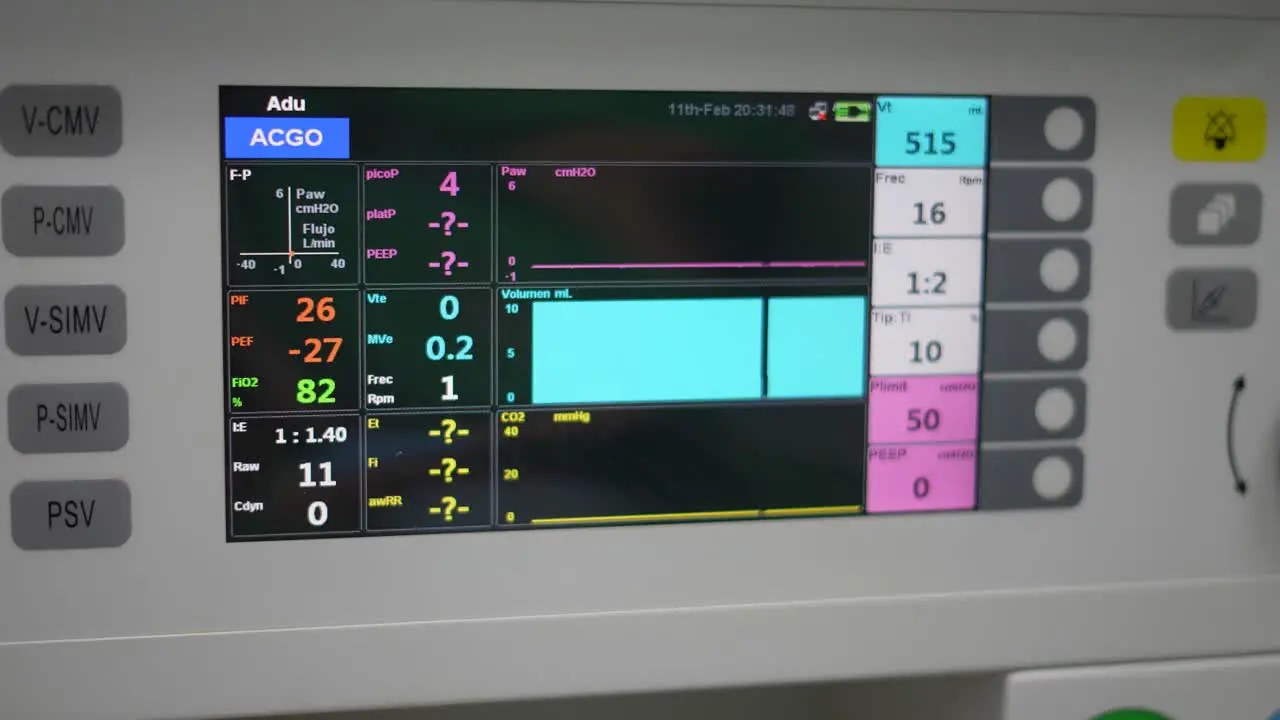 Display device of a medical monitor as used in anesthesia hospital monitor