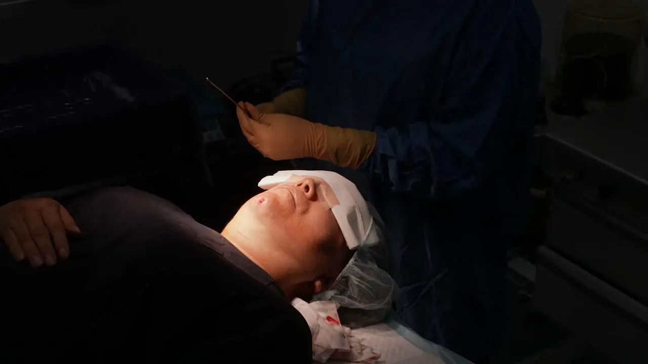 jowl liposuction surgery in operating room doctor operating on face obesity operation cosmetic surgery removal of fat cells