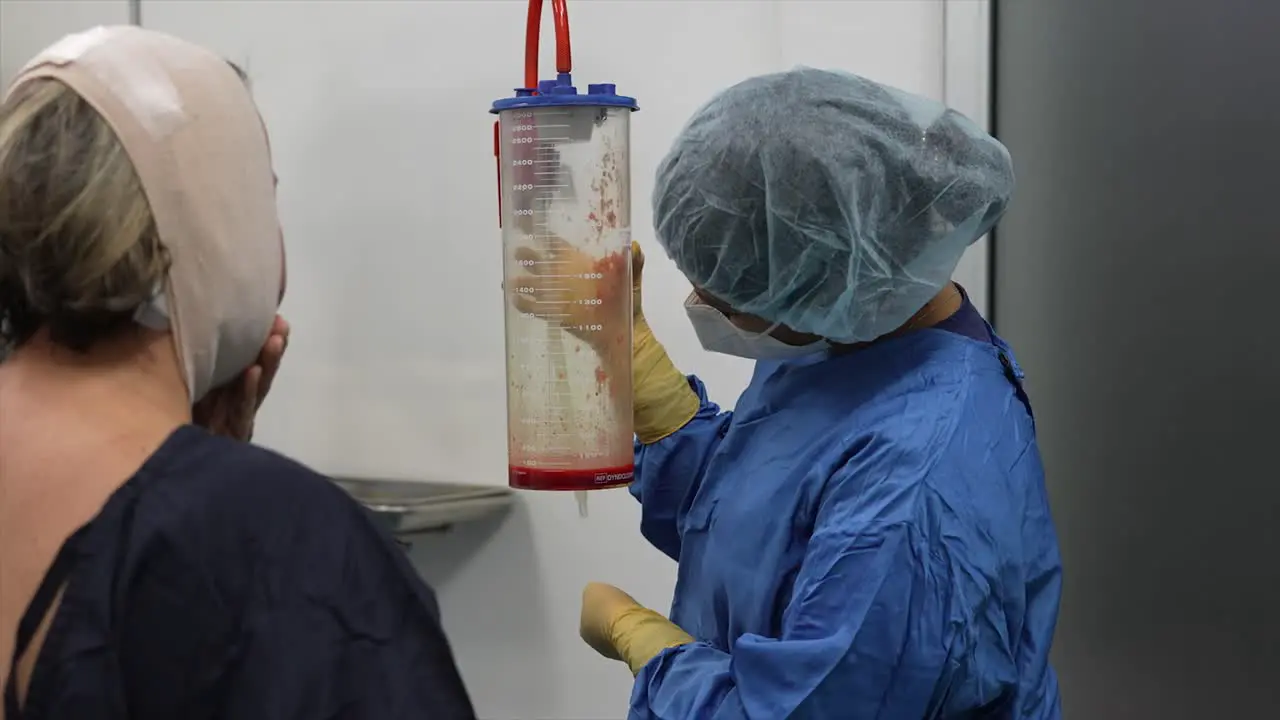 doctor showing removal of fat from jowls and stomach with liposuction blood with fat operating room